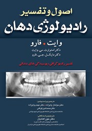 معرفی و دانلود کتاب اصول و تفسیر رادیولوژی دهان وایت فارو: تفسیر رادیوگرافی، پوسیدگی‌های دندانی