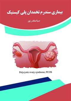 عکس جلد کتاب بیماری سندرم تخمدان پلی کیستیک